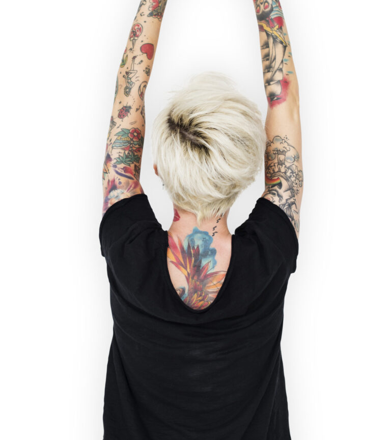 tetoválás eltávolítása